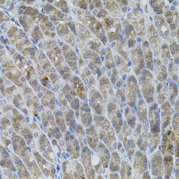 UBE2A Antibody