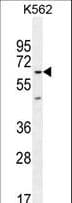 KBTBD5 Antibody (aa349-377)