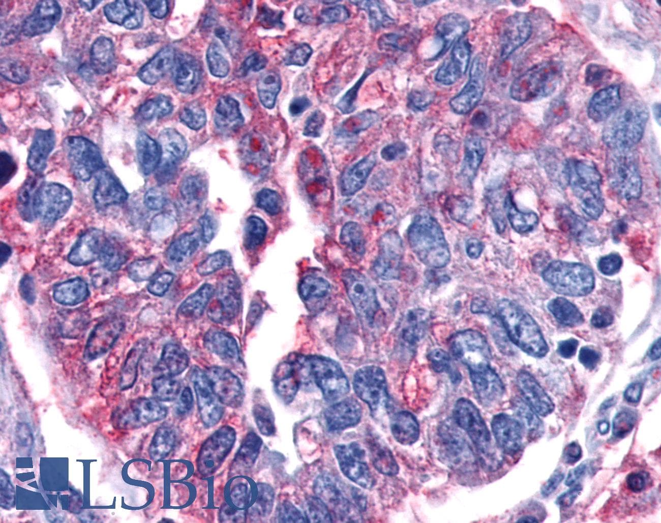 PathPlus™ Polyclonal Rabbit anti-Human GPR80 / GPR99 / OXGR1 Antibody (Extracellular Domain, IHC)