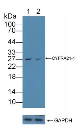 CYFRA21-1 Antibody