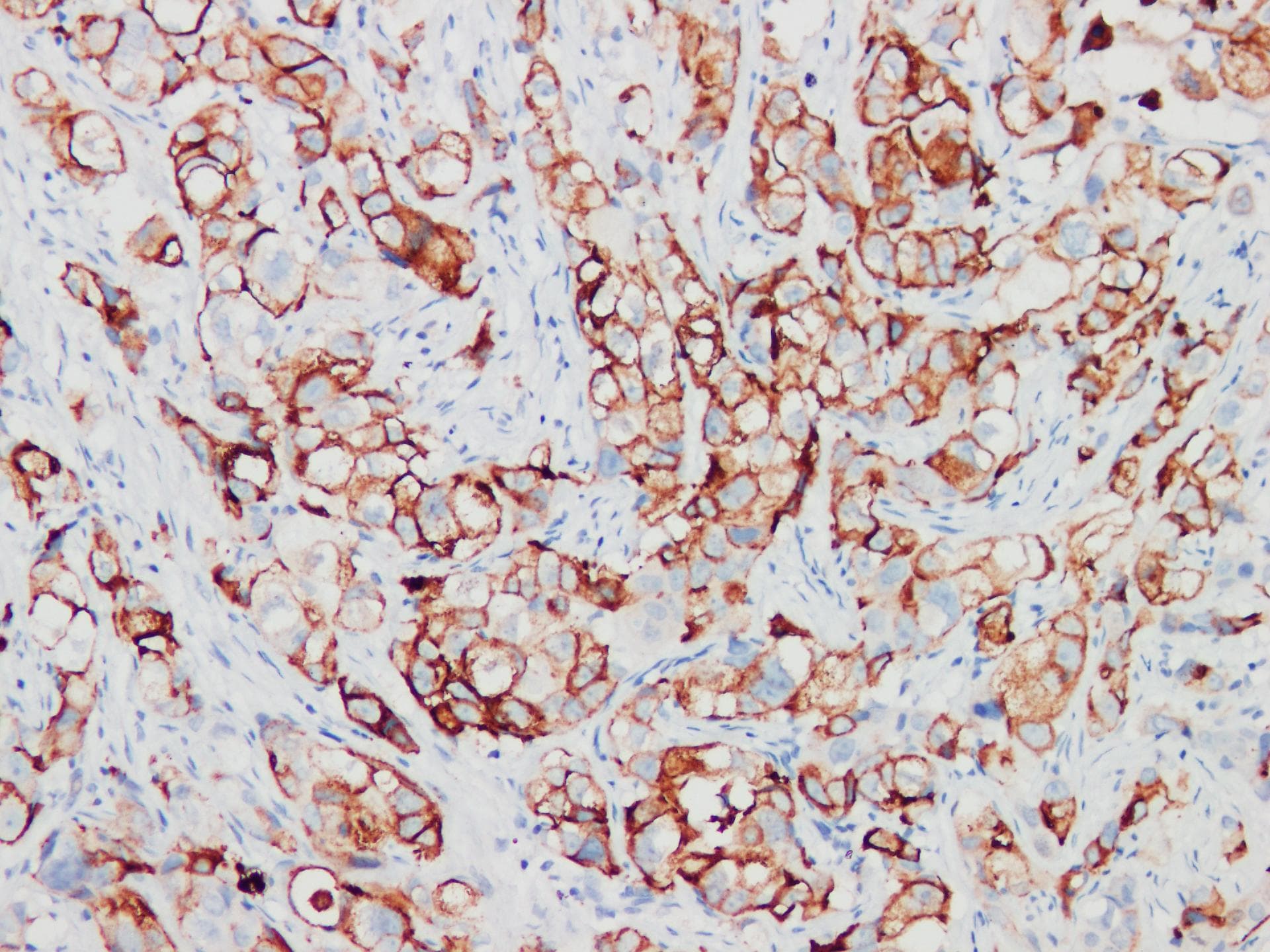 PIP / GCDFP-15 Antibody