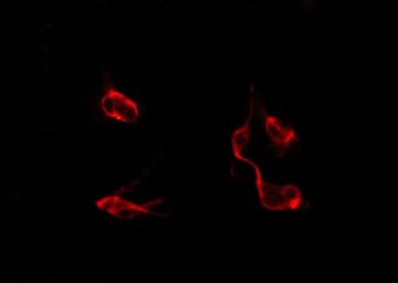 DP97 / DDX54 Antibody