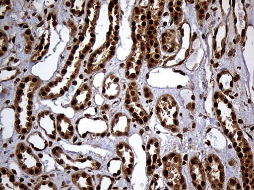 RAD21 Antibody (aa193-458, clone OTI2A12)