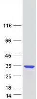 Human ZC4H2 Protein (Recombinant Myc-DDK (Flag))