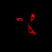 H6PD / G6PDH Antibody