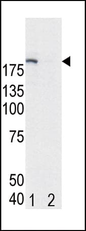 Polyclonal Rabbit anti-Human EGFR Antibody (phospho-Tyr1172, WB)
