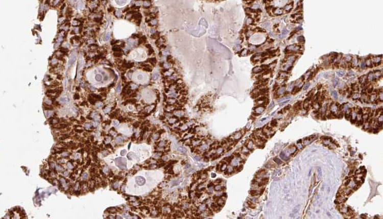 WIPI2 Antibody