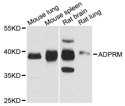 ADPRM Antibody