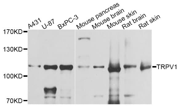 Polyclonal Rabbit anti-Human VR1 / TRPV1 Antibody (WB)