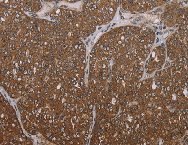 FOLH1B Antibody