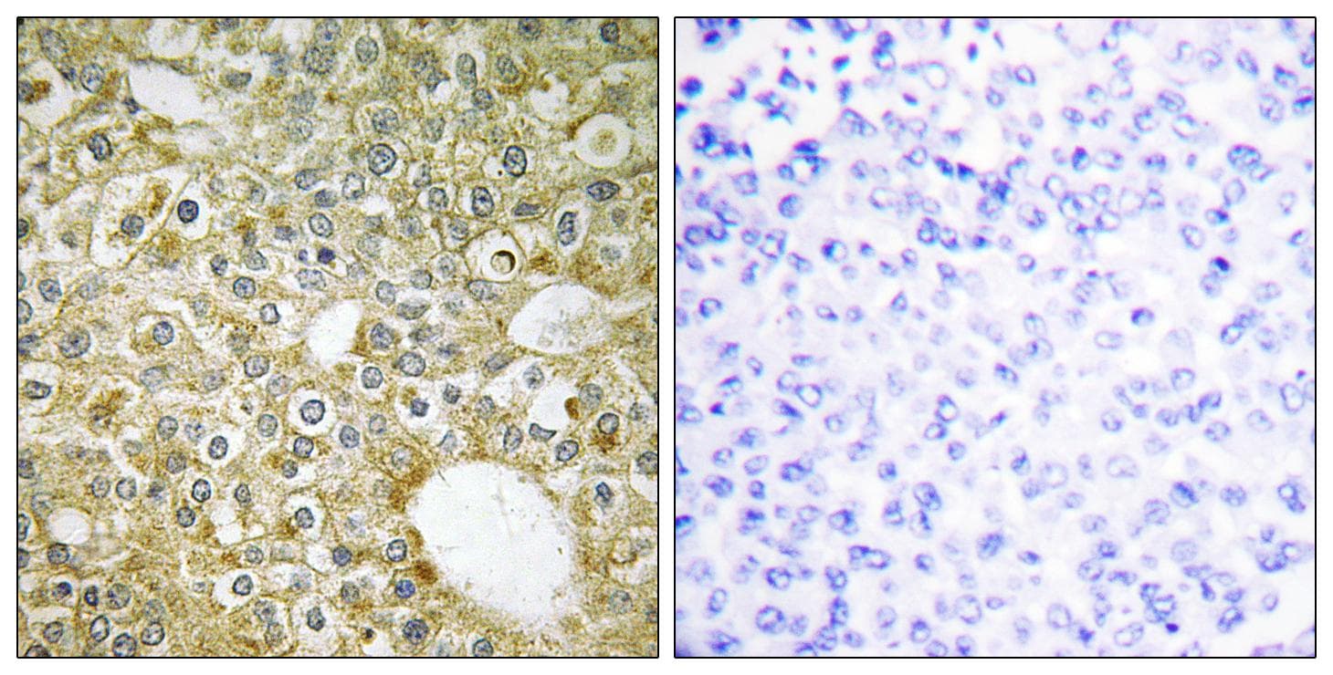 ACVRL1 Antibody