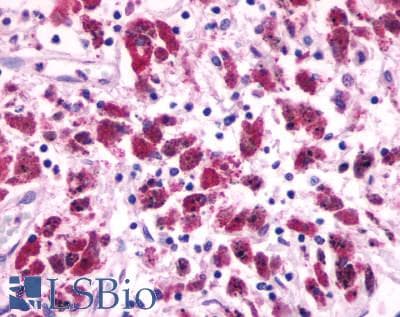 PathPlus™ Polyclonal Rabbit anti-Human CXCR4 Antibody (N-Terminus, IHC)
