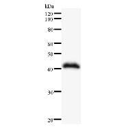 Monoclonal Mouse anti-Human SMARCA4 / BRG1 Antibody (clone SMAR9G1F9, WB)