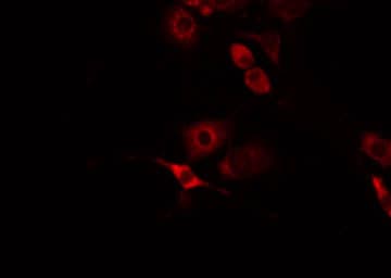 FZD8 / Frizzled 8 Antibody
