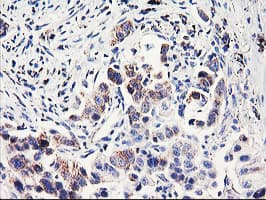 PDSS2 / DLP1 Antibody (clone OTI2A3, Carrier-free)