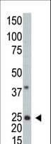 ARFL3 / ARL3 Antibody (aa1-30)