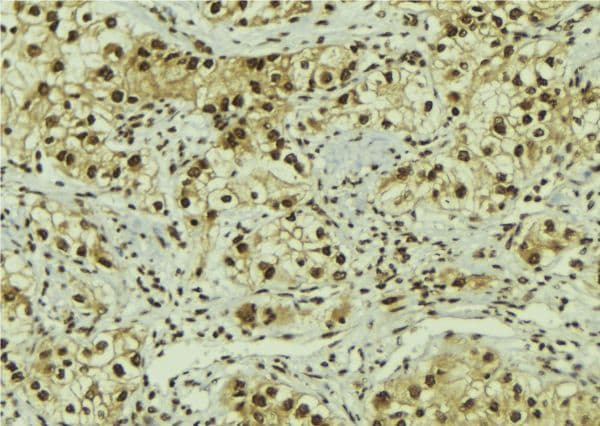 FOXO1 / FKHR Antibody (Acetyl-Lys294)