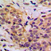 Polyclonal Rabbit anti-Human MRPL11 Antibody (Internal, IHC, IF, WB)