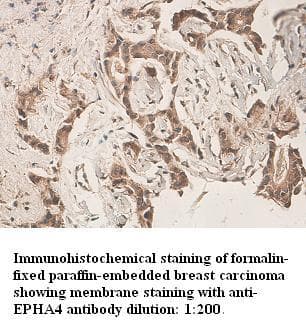 Polyclonal Rabbit anti-Human EPHA4 / EPH Receptor A4 Antibody (IHC)