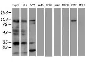 ERCC1 Antibody (clone OTI1C10, Carrier-free)