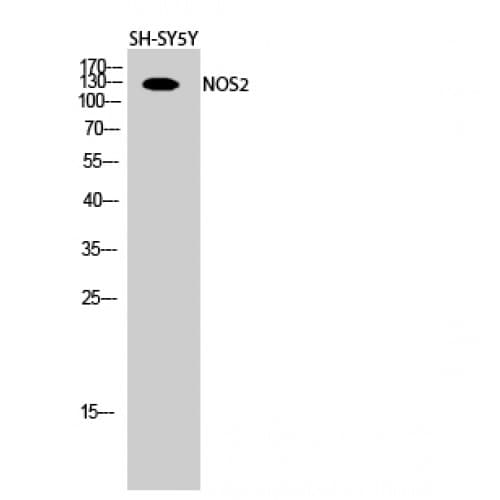 PathPlus™ NOS2 / iNOS Antibody (90-170 aa)