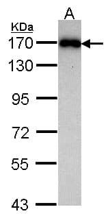 Polyclonal Rabbit anti-Human MAGI2 / AIP-1 Antibody (aa1393-1455, WB)