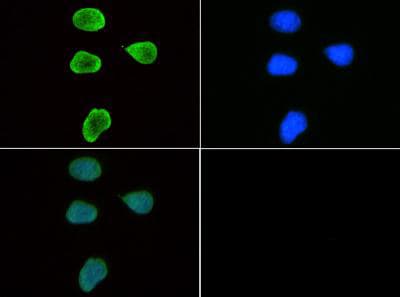 HIST3H3 Antibody (Me3-Lys9)