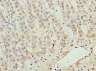 ZNF226 Antibody