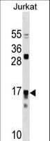 Polyclonal Rabbit anti-Human IL17RC Antibody (aa103-131, WB)