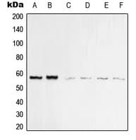 Polyclonal Rabbit anti-Human Vimentin Antibody (C-Terminus, IHC, IF, WB)