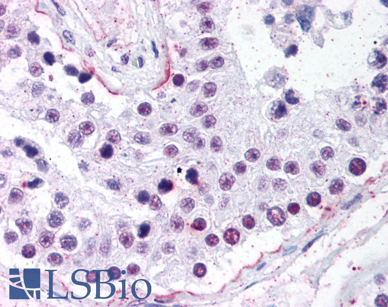 IHC-plus™ RAD50 Antibody (aa1-425, clone 13B3)