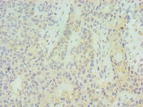 SUV39H2 Antibody (aa201-410)