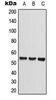 Polyclonal Rabbit anti-Human CLEC14A Antibody (Internal, WB)