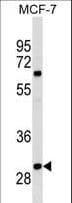 Polyclonal Rabbit anti-Human OR4M2 Antibody (aa243-271, WB)