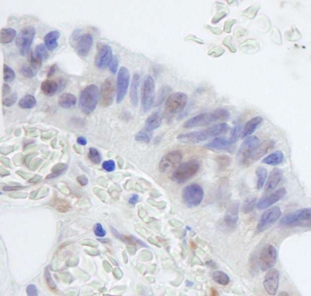 RNF20 Antibody (aa125-175)