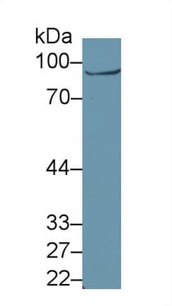 GLNRS / QARS Antibody
