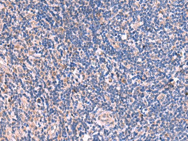 MPP1 Antibody