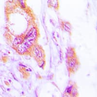 KRT19 / CK19 / Cytokeratin 19 Antibody (C-Terminus)