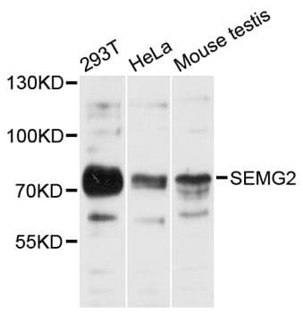 Polyclonal Rabbit anti-Human SEMG2 Antibody (WB)