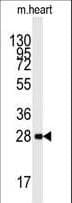 IHC-plus™ Polyclonal Rabbit anti-Human PRKAB1 / AMPK Beta 1 Antibody (aa4-34, IHC, WB)
