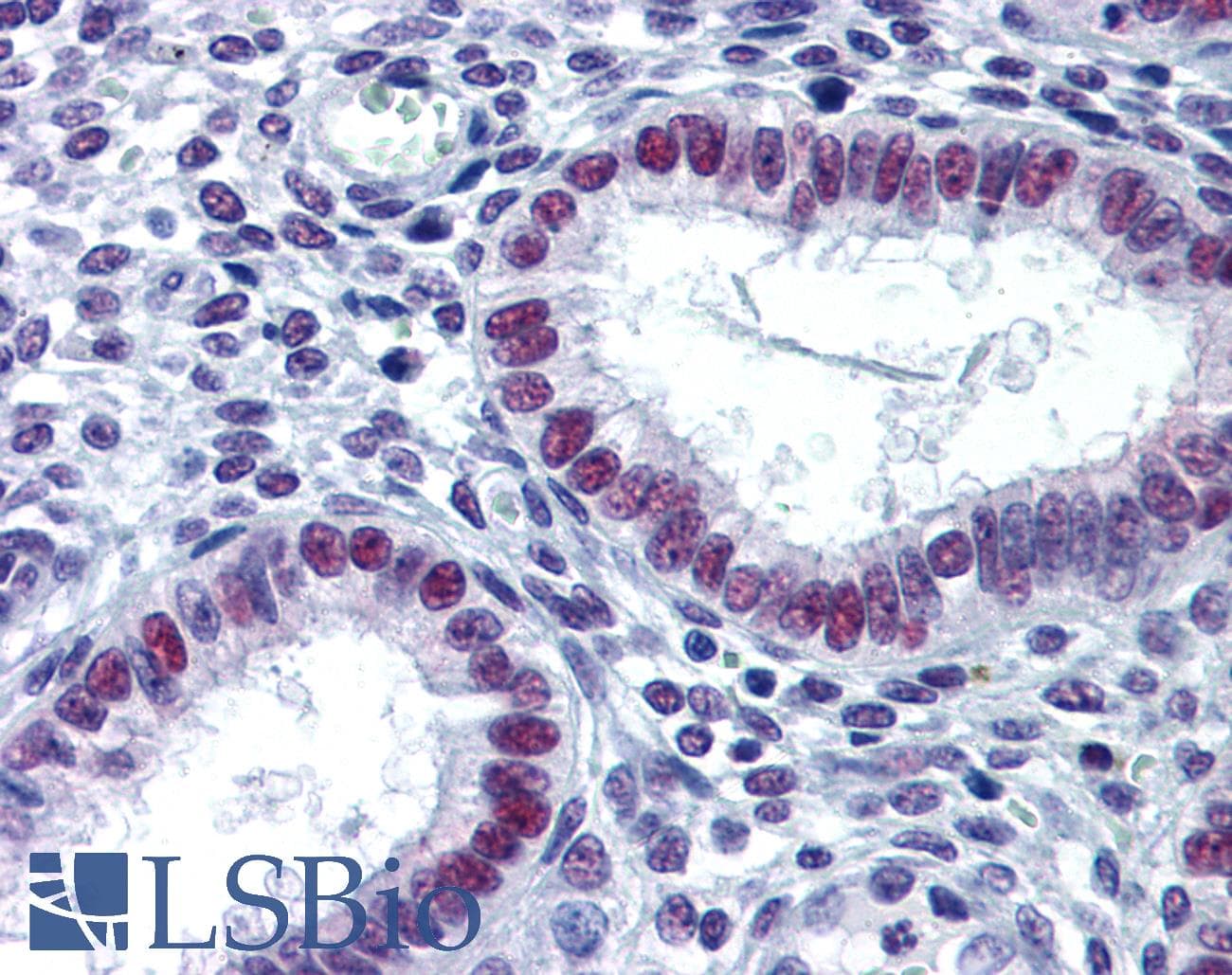 IHC-plus™ Monoclonal Mouse anti-Human KDM1A / LSD1 Antibody (clone 2E7, IHC, IF, WB)