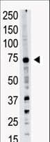PRDM14 Antibody (aa1-30)