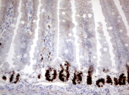 MKI67 / Ki67 Antibody (aa1160-1493, clone UMAB107, Carrier-free)