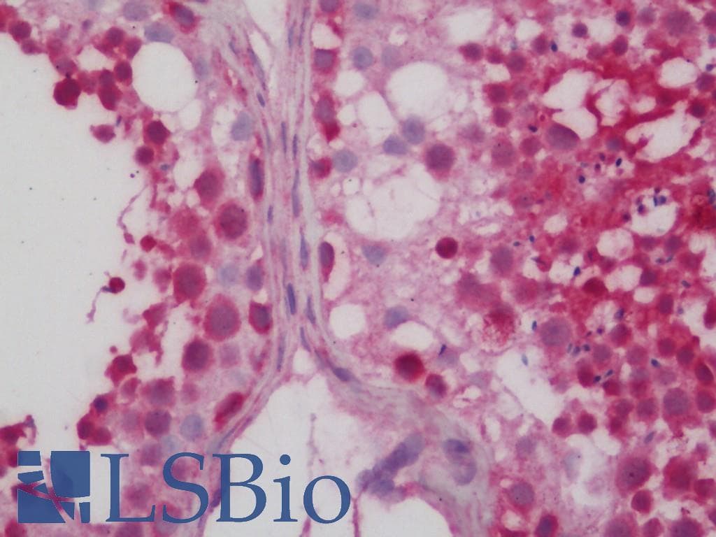 IHC-plus™ Polyclonal Rabbit anti-Human SHMT / SHMT1 Antibody (aa453-483, IHC, WB)