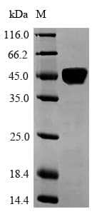 Human p56lck / LCK Protein (Recombinant 6His-SUMO, N-terminus)