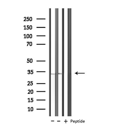 KCNK7 / K2p7.1 Antibody