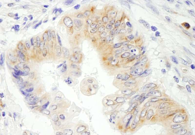 STC2 / Stanniocalcin 2 Antibody (aa252-302)