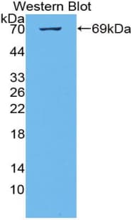 KIAA1524 / p90 Autoantigen Antibody (aa230-560)
