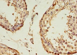 B3GNT5 Antibody (Biotin)