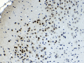 CHAT Antibody